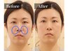 【ほうれい線・たるみ】30代からの骨格リフトアップ小顔矯正 ¥15900→¥3500