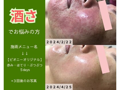 ピオニー(peony)の写真