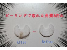 プチサロン ミニョンヌ(Petit Salon Mignonne)/ピーリングで角質除去！！