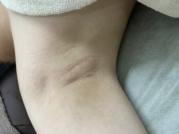 ナノハナ/鹿沼市の全身脱毛美容室ナノハナ