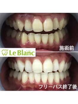 ルブラン 奈良店(Le Blanc)/【人気のフリーパスコース】