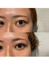 ウェヌス アイ ビューティ(VENUS eye beauty)/ラッシュアディクト