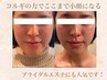 【*即効 小顔* 頭蓋骨矯正付 】オーダーメイド小顔コルギ　90分¥7900