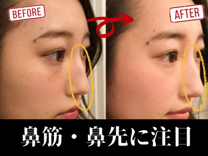 ラプリシュシュ 岡山店(Raplit)の写真