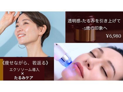 アプロ(Aphro)の写真