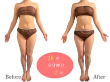 アルピナ(ALPINA)/ウルトランスフォーマー