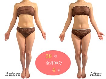 アルピナ(ALPINA)/ウルトランスフォーマー