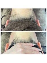 ミース 川崎店/うなじ矯正◆ビフォーアフター