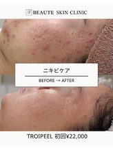 ボーテスキンクリニック/トロイピール【TROIAREUKE】