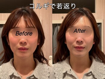 薬手名家 心斎橋店/お客様ビフォーアフター