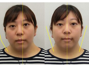 宮崎整体院/【美容整体】全身根本改善コース