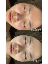 エクラ(ECLAT)/クールビタミン導入♪