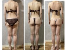 スリーピングビューティー(Sleeping Beauty)/