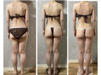 スリーピングビューティー(Sleeping Beauty)/