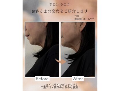 サロン シエラの写真