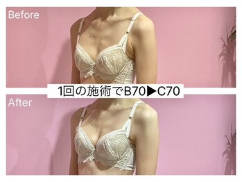ククナ 新潟本店(KUKUNA)/*バストアップケア*