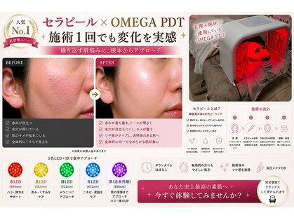 ノエル(Noel)の写真