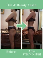 ダイエット アンド ビューティー アーシャ(Diet & Beauty Aasha)/ビーナスボディ施術例