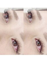 レア(le`a)/バインドラッシュ 100束