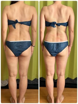 ヨサ パーク コアハート(YOSA PARK CORE HEART)/