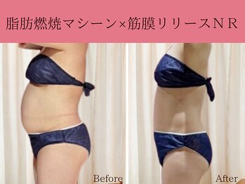 ココロ(COCORO)/理想のボディーを叶えます