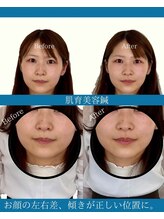 ハリラボ(hari Lab.)/【お客様の声】