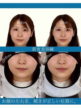 ハリラボ(hari Lab.)/【お客様の声】