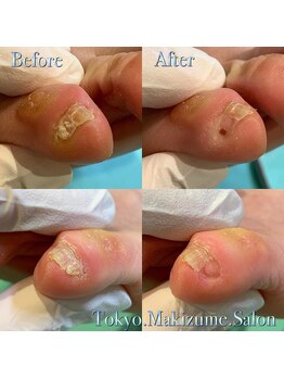 巻き爪補正店 町田店/