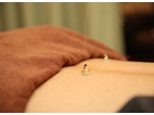 ハル(haru)の雰囲気（お灸）