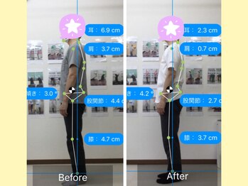 ナオル整体 春日部院(NAORU整体)/施術を重ねて、綺麗な姿勢に!