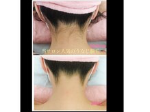 リッチアンビューティー(Rich.an beauty)の雰囲気（大人気のうなじ脱毛◎後ろ姿にも自身が持てます♪成人式などにも）