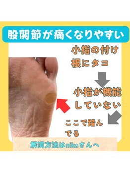 ニコ(niko)/小指が使えていない証拠です