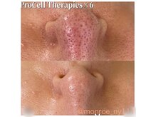 エイミー(Amy)の雰囲気(毛穴にはプロセル一択(^^))