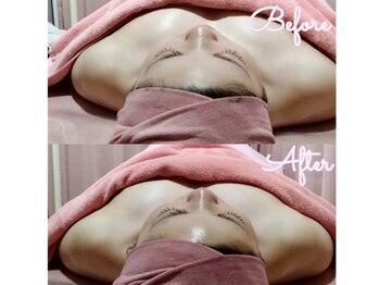 ユーアンドミー(You&Me)/巻き肩解消マッサージ