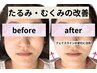 【90分：小顔矯正×全身整体】本格小顔ケア/顎のズレ・たるみ