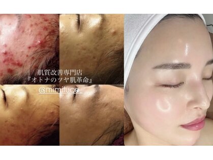 ミミルーチェ(mimiluce)の写真