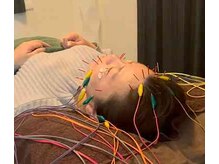 エザキ鍼灸院 接骨院(EZAKI鍼灸院 接骨院)/立体造顏美容鍼