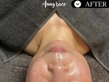 アングレイス(Anngrace)/護りの抗酸化【ポールシェリー】