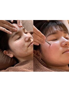 小顔になりたい