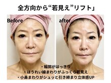 マリア(MALIA)/60代の方　南森町レッドショット