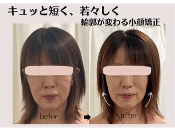 オリナサツキ(OlinaSatsuki)