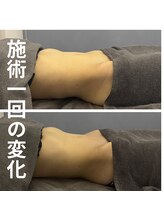 リア(Lia)/3ヶ月ぶりの腸ケア