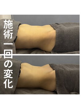 リア(Lia)/3ヶ月ぶりの腸ケア