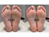 [サンダルを履く方必見!!]フット角質徹底ケア→¥5,500