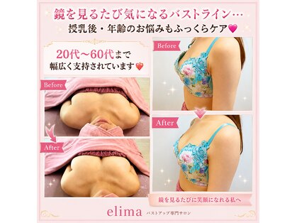 エリマ(elima)の写真