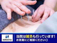 ノモコツ鍼灸 整骨院 赤羽スズラン通り院(NOMOKOTSU鍼灸 整骨院)の雰囲気（痛み、だるさ、しびれ等のお身体の不調も鍼施術で幅広く対応◎）