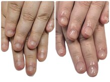 ブルームブルーム(BLOOMブルーム)/爪の大きさは変わります