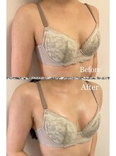 プリマベラ 大阪梅田(primabella)/下着が浮くのが気になる方へ