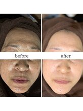 マーギアー(Magier)/ハーブ＋ダーマ　初来店→７回目