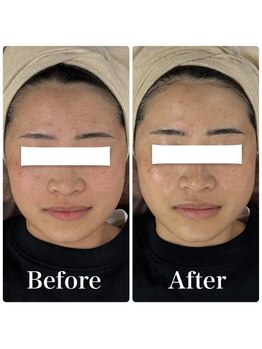 ソアー(Soar)/フェイシャル/クリスティーナ